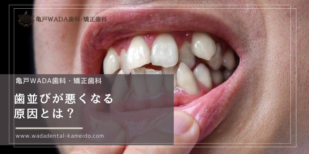 歯並びが悪くなる原因とは？