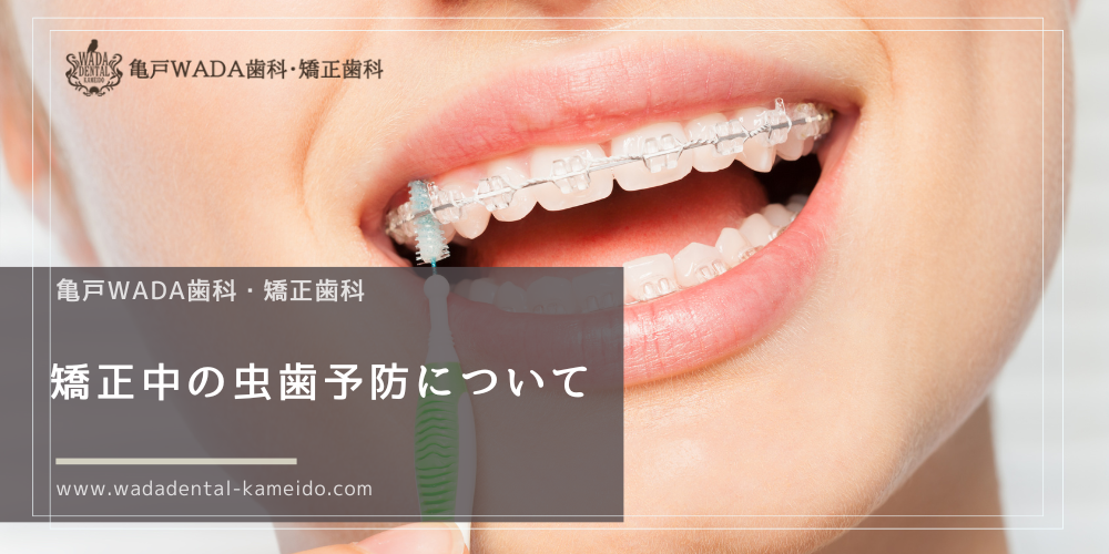 矯正中の虫歯予防について